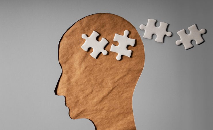 Memory,Loss,From,Dementia,,Parkinson,Or,Alzheimer,Disease,Concept.,Brain Memory,Loss,From,Dementia,,Parkinson,Or,Alzheimer,Disease,Concept.,Brain